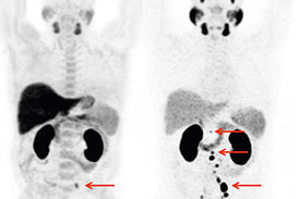 Computerassistierte Chirurgiesysteme sollen präzise, minimalinvasive Eingriffe ermöglichen. Auch beim Prostatakarzinom werden sie bereits eingesetzt.