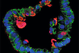 Mikroskopieaufnahme eines Eileiterorganoids im Querschnitt. Die mit Chlamydien infizierten Bereiche (rot) sind gut zu erkennen.