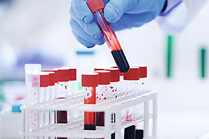 Blutproben in Reagenzgläsern