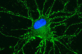 Dargestellt ist ein Neuron des Hippocampus eines Nagetiers, das in einer Zellkultur gezüchtet wurde. 