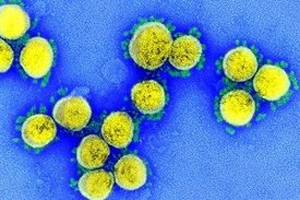 SARS-CoV-2: Viruspartikel im Elektronenmikroskop