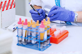 Deutschlandweit werden Forscherinnen und Forscher rund 18.000 Blutproben von Kindern und Jugendlichen auf Antikörper gegen das Virus testen. 