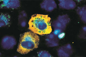 Infiziert SARS-CoV-2 (gelb) Affennierenzellen, drosselt es deren Recycling-Mechanismus: Es finden sich weniger Autophagie-Signale (grün) als in nicht infizierten Zellen. Zellkerne sind blau angefärbt.