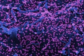 Vero6-Zellen infiziert mit SARS-CoV-2