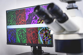 Eine RUB-Medizinerin hat entdeckt, wie das Coronavirus in die Herzmuskelzellen eindringt.