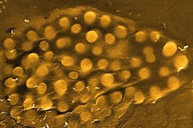 Invasion einer Wirtszelle durch Staphylokken