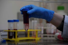 Isolation von Immunzellen aus dem Blut.