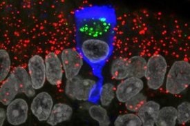 Grafik einer infizierten Zelle, umgeben von nicht-infizierten Zellen